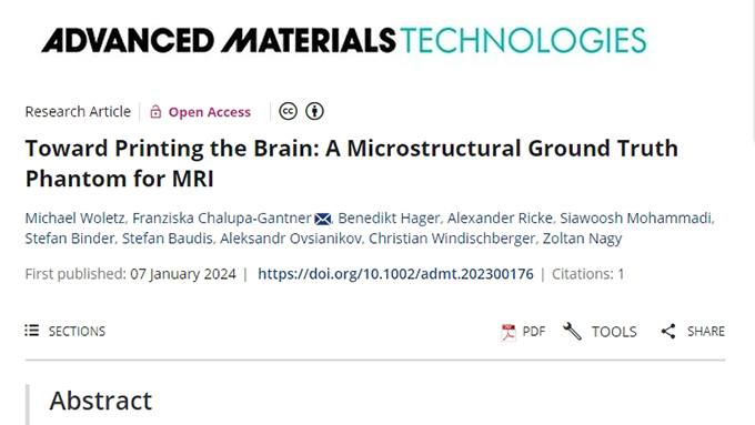 世界上第一個由3D打印機(jī)開發(fā)的高分辨率大腦模型